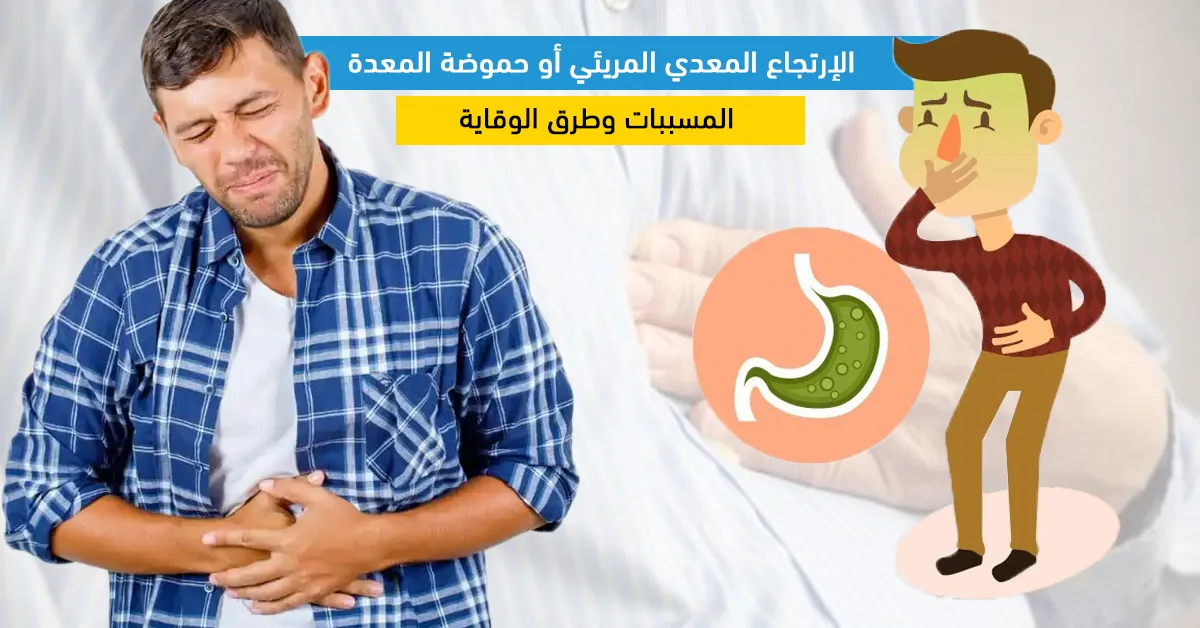 الإرتجاع المعدي المريئي أو حموضة المعدة: المسببات وطرق الوقاية